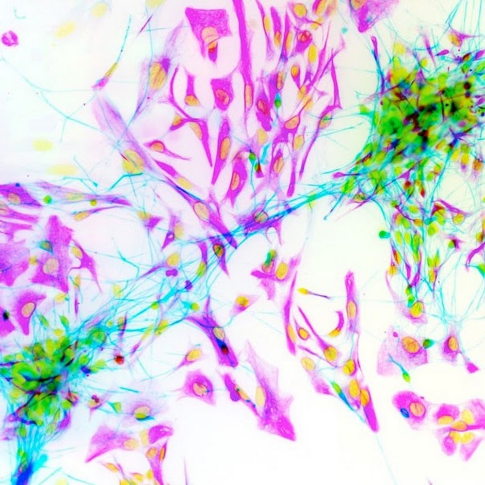 Meet your Posher, A.